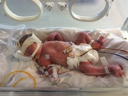 Neonatalbaby1